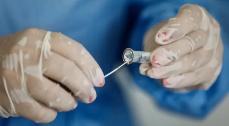 20 estados e DF apresentam alta incidência de casos de Covid-19, diz instituto